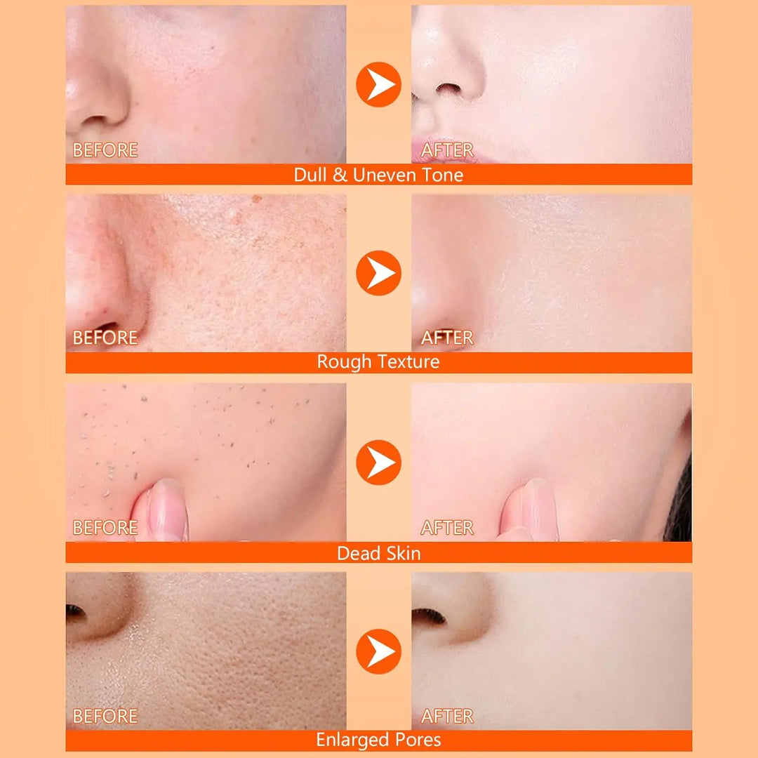Body-Keratin-Care-Kojic-Acid-Turmeric-Spray-Gently-Exfoliating-Peeling-Solution-Nourishing-Hydrating-Skin-Care-All.jpg